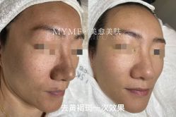 -美愈美肤MEIYU SKIN