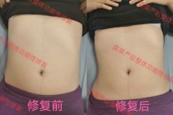 点击看大图 -奕美功能性体态调整·塑型·产后恢复(永利国际店)