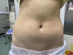 -上海漾颜医疗美容