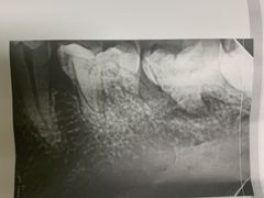 -上海市杨浦区牙病防治所