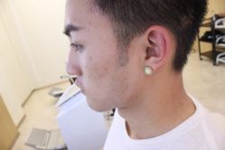 点击看大图 -大麦微针植发丨全国连锁