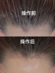 -MISS STAR·半永久纹眉·发际线·美瞳线