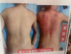 -瘦立方身材管理中心