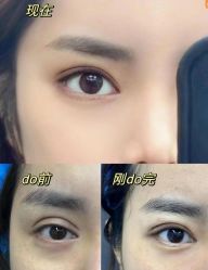 -紫洁俪方（北京）医疗美容