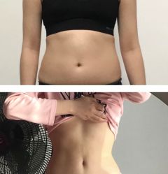 -上海漾颜医疗美容