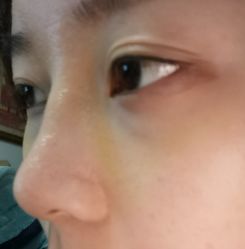 -成都西区医院整形美容