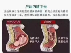 点击看大图 -昕孕瑜伽·孕妇瑜伽·产后修复