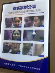 -成都军建医院·疤痕诊疗中心