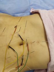 -清媚减肥瘦身纤体