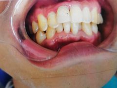 -微笑牙科口腔(三亚迎宾院区)