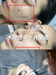 点击看大图 -ROYEA茹彦祛痘·问题肌肤修护中心