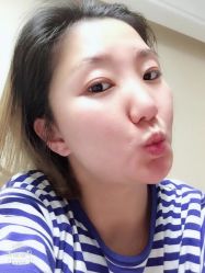 -美丽人生祛斑扁平疣汗管瘤中心