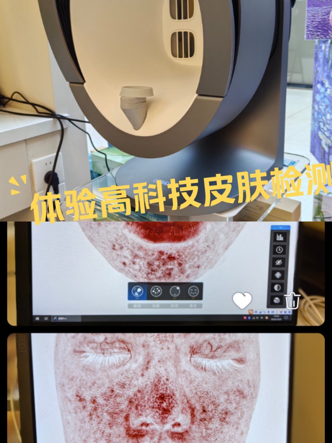 皮肤检测仪