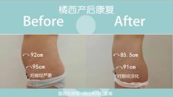 -橘西产后康复中心