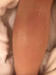 -苑苑vbeauty科技美容SPA