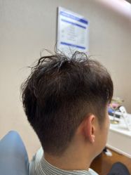 -大麦微针植发全国连锁