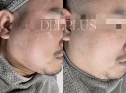 -Deeplus+韩国皮肤管理한국피부관리·C:Lab肌肤实验室