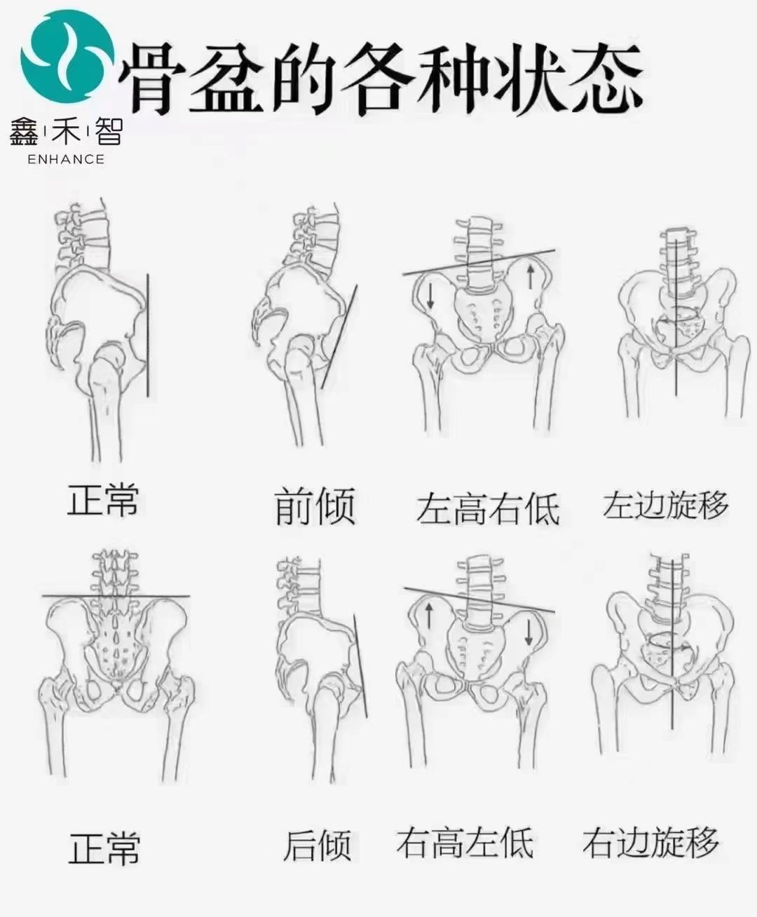 男性骨盆测量正常值图图片