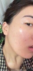 -长沙雅美医疗美容医院