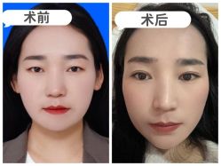 -素美医疗美容·西南眼鼻整形·修复基地