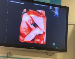 -杭州贝瑞斯美华妇儿医院·早孕·产检·儿科