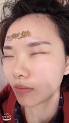 -郡艺医疗美容·微整·眼鼻吸脂