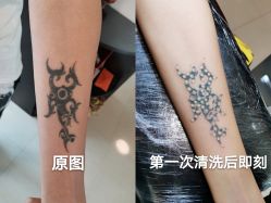 -秦好山专业洗纹身