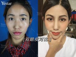 -Yestar艺星医疗美容医院