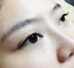 -初樱科技美学问题肌修复中心