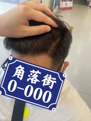 -大麦微针植发全国连锁