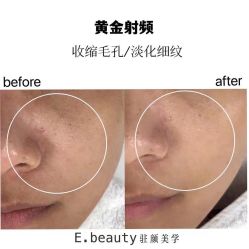 -E.beauty驻颜·痘敏肌调理中心