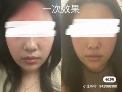 -MUFI·美悦菲塑颜美容SPA