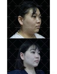 -洁铭新加坡医美