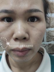 -深圳春天阳光医院·轮廓抗衰中心