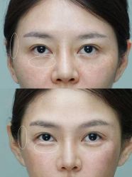 -深圳艺星医疗美容医院