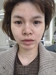 体验后-杭州奥拉克医疗美容门诊部