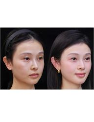 -上海伊莱美医疗美容医院