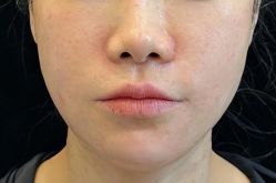 -天津健丽·去眼袋医疗美容机构