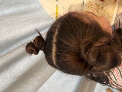 -碧莲盛·不剃发植发