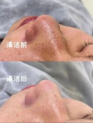 -LUNA皮相美·骨相美高级美感