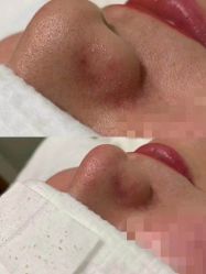 点击看大图 -苑苑vbeauty科技美容SPA
