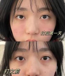 -丰联丽格医疗美容·联合丽格眼整形中心