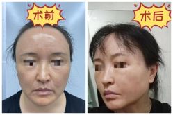 -素美医疗美容·西南眼鼻整形·修复基地