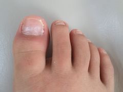 -新甲连锁灰指甲·甲沟炎·鸡眼(黑龙江路店)