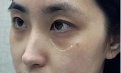 -上海伊莱美医疗美容医院