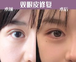 -上海漾颜医疗美容