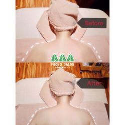 -FACE·日本小颜矫正美容整骨サロン