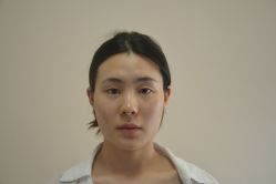 -成都西区医院整形美容