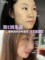 -Yestar艺星整形美容医院