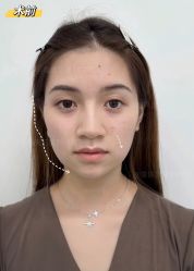 -Yestar重庆艺星医疗美容医院